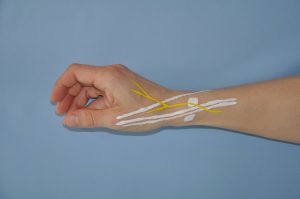 Bild 3: Postoperativer Zustand